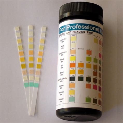 urine albumin test kit